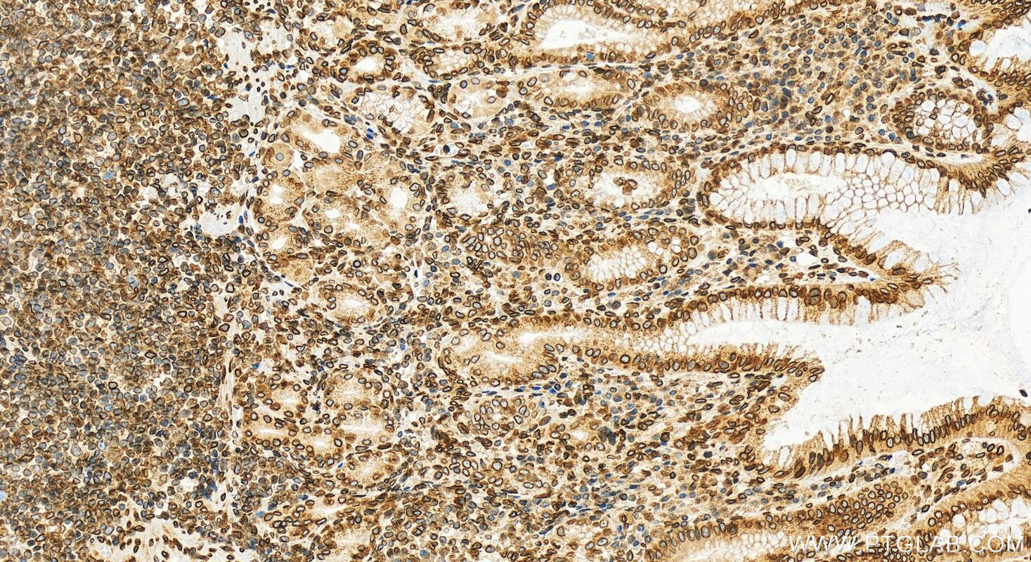 Immunohistochemistry (IHC) staining of human stomach tissue using SUN2 Polyclonal antibody (27556-1-AP)