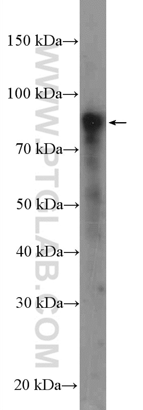 Western Blot (WB) analysis of mouse testis tissue using SUN2 Polyclonal antibody (27556-1-AP)