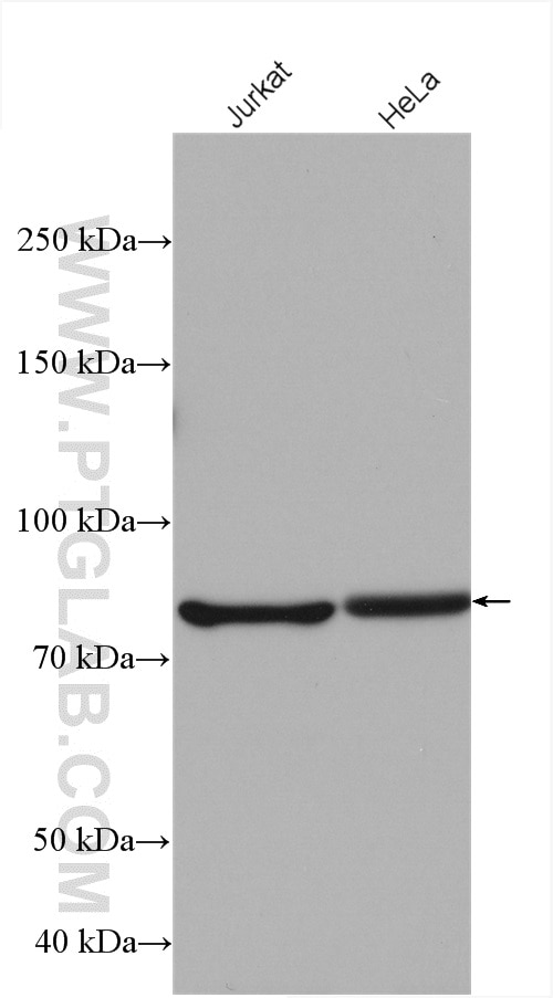 Western Blot (WB) analysis of various lysates using SUN2 Polyclonal antibody (27556-1-AP)
