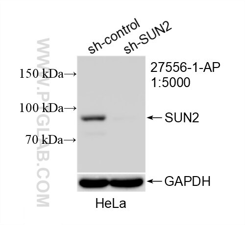 Western Blot (WB) analysis of HeLa cells using SUN2 Polyclonal antibody (27556-1-AP)