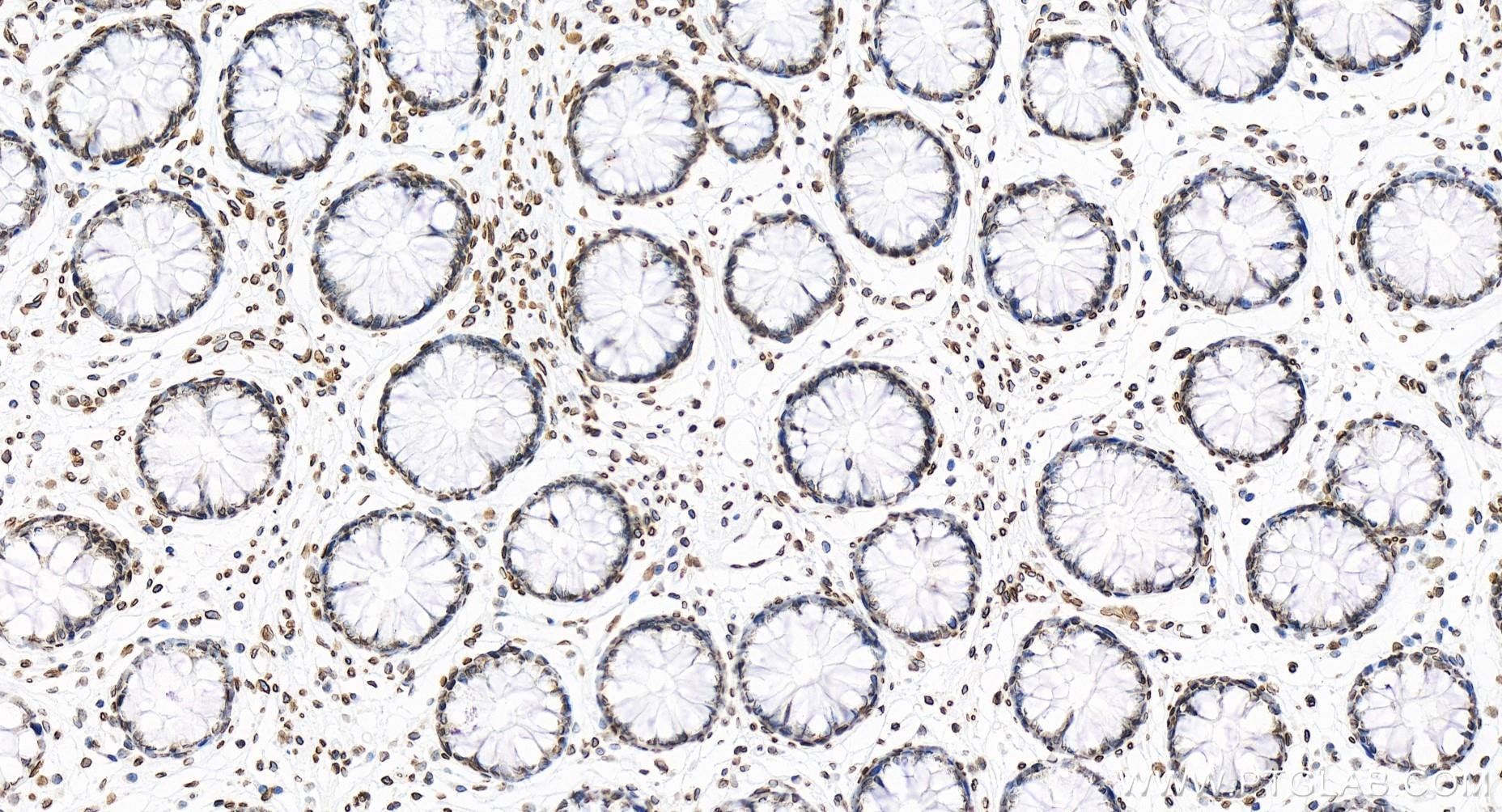 Immunohistochemistry (IHC) staining of human colon tissue using SUN2 Recombinant antibody (85103-3-RR)
