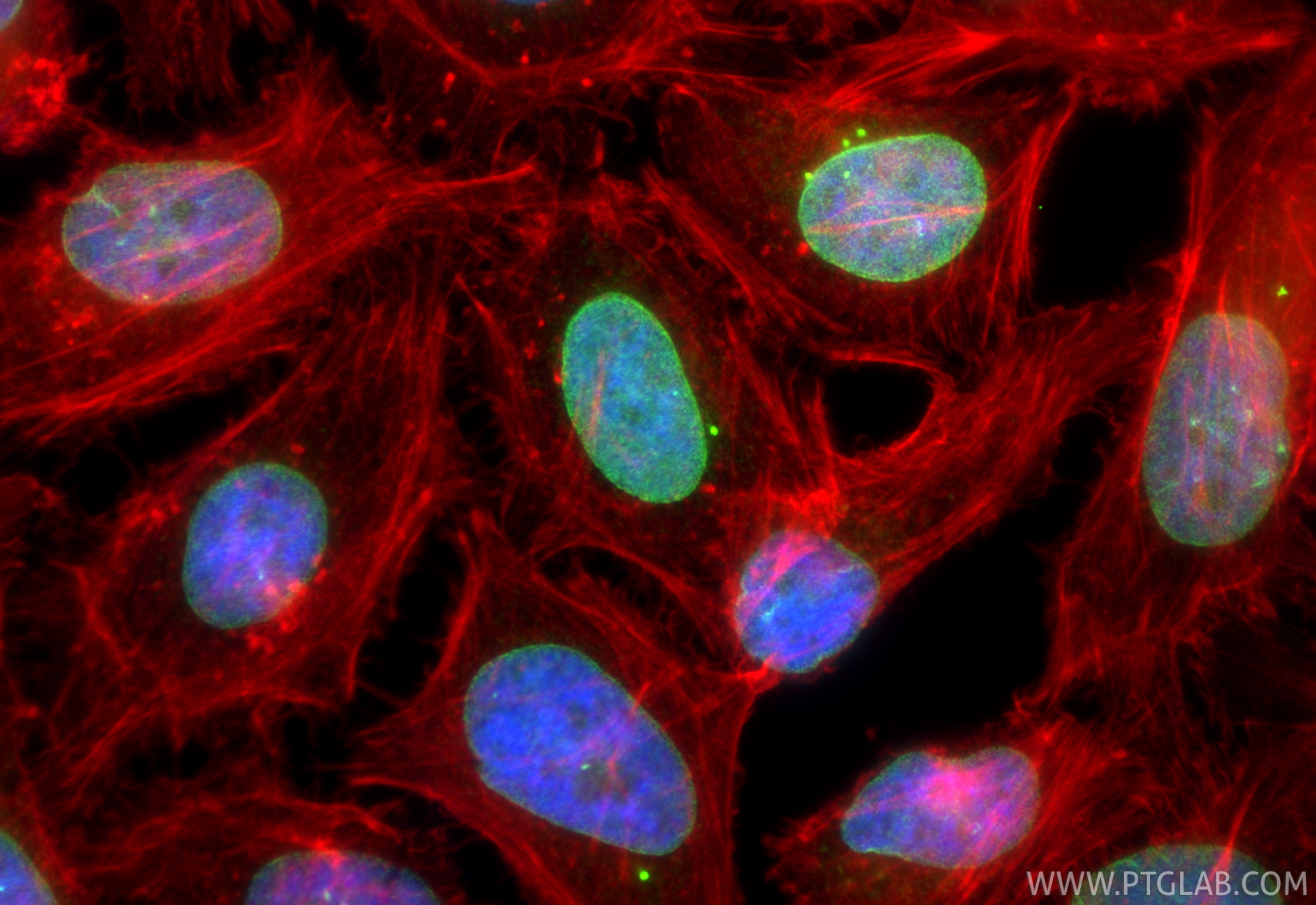Immunofluorescence (IF) / fluorescent staining of HeLa cells using SUN2 Recombinant monoclonal antibody (85103-3-RR)