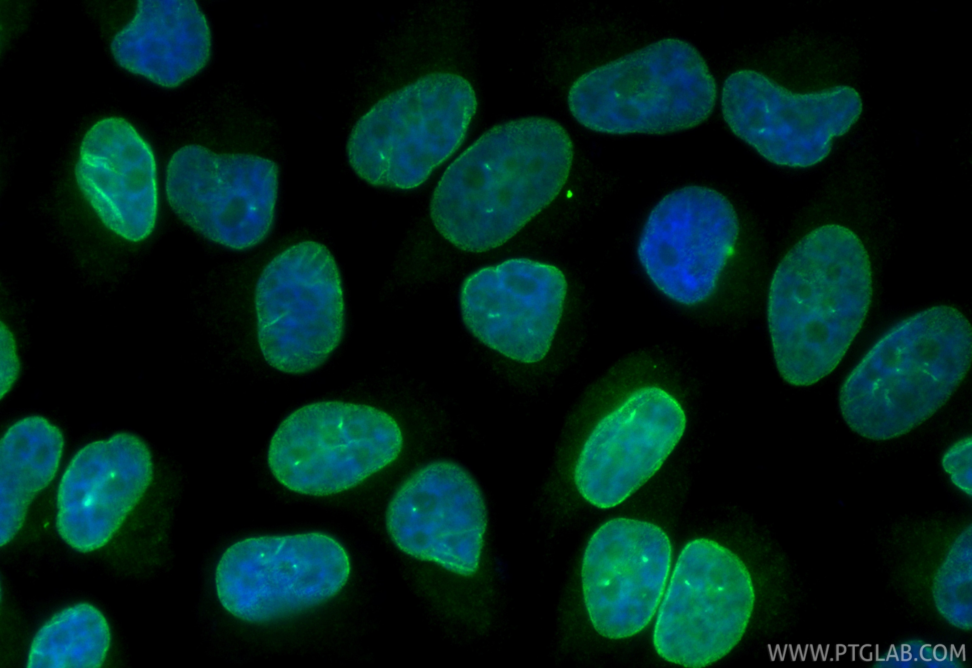 Immunofluorescence (IF) / fluorescent staining of HeLa cells using CoraLite® Plus 488-conjugated SUN2 Recombinant mon (CL488-85103-3)
