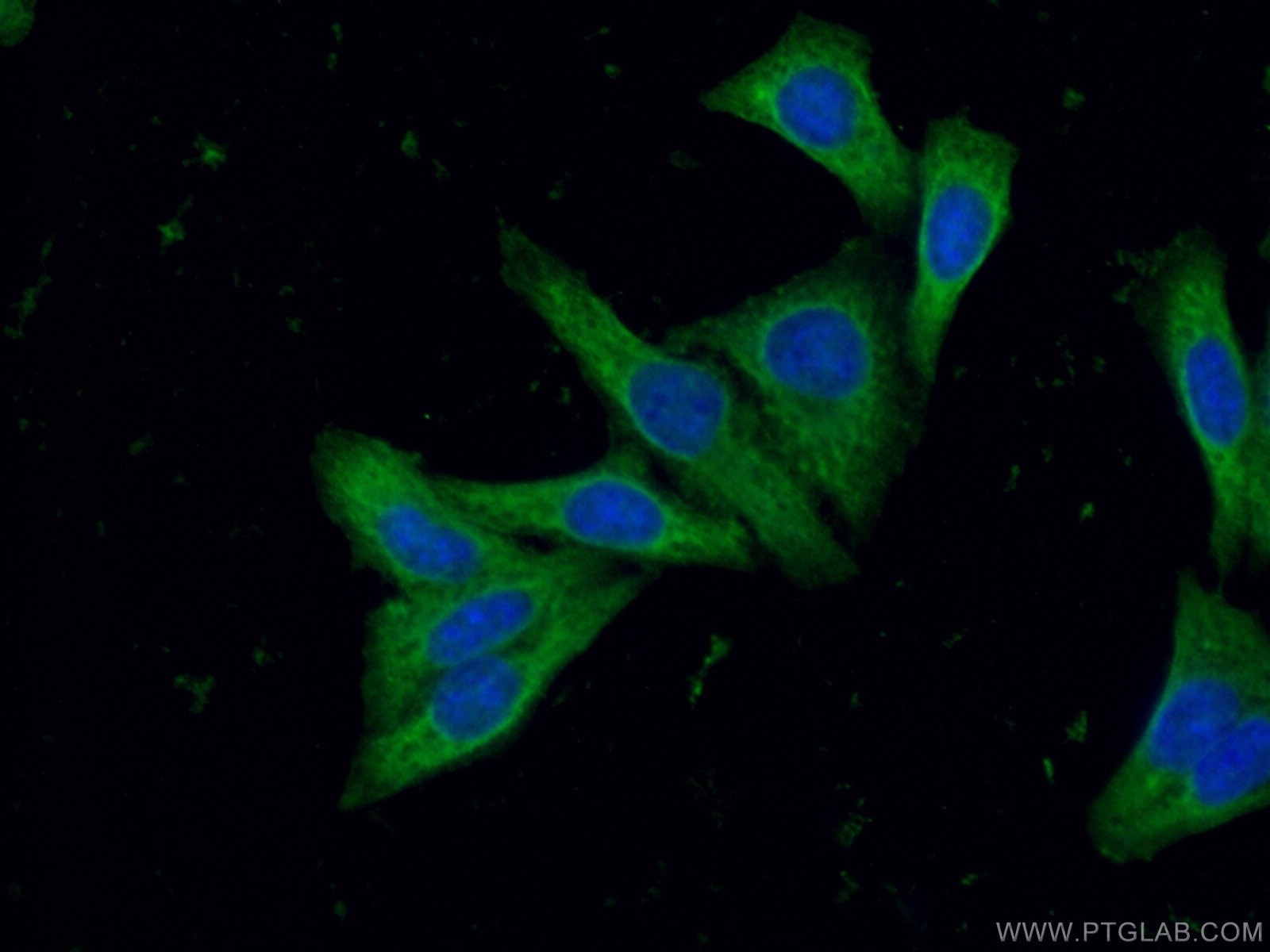 Immunofluorescence (IF) / fluorescent staining of HepG2 cells using SUNC1 Polyclonal antibody (26434-1-AP)