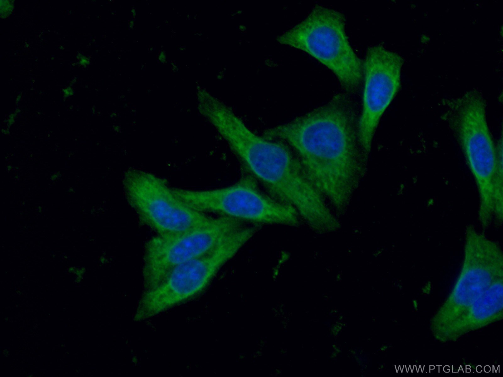 IF Staining of HepG2 using 26434-1-AP