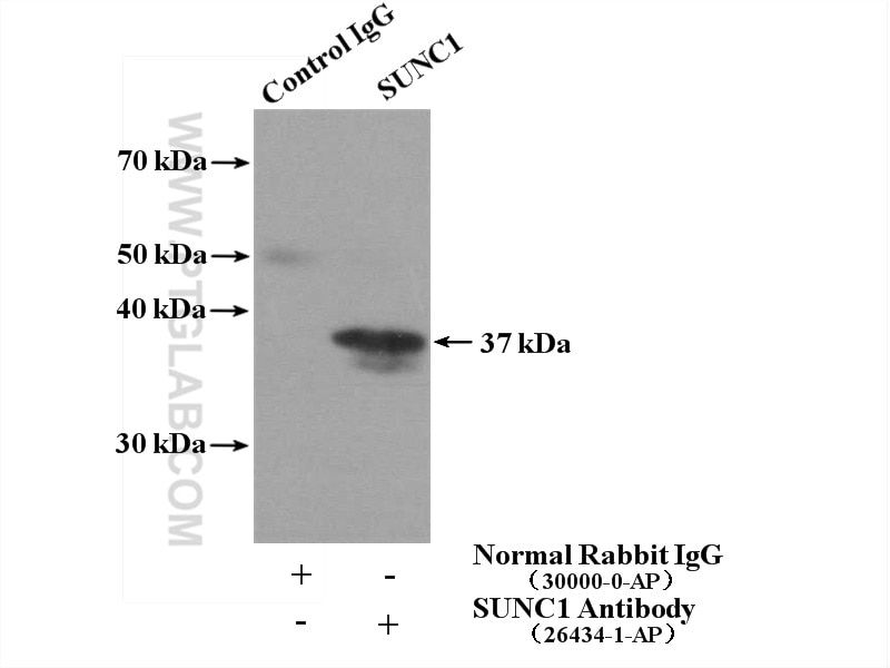 Immunoprecipitation (IP) experiment of mouse testis tissue using SUNC1 Polyclonal antibody (26434-1-AP)