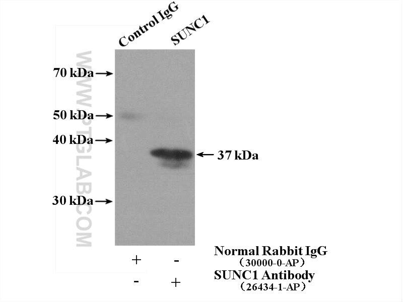 Immunoprecipitation (IP) experiment of mouse testis tissue using SUNC1 Polyclonal antibody (26434-1-AP)