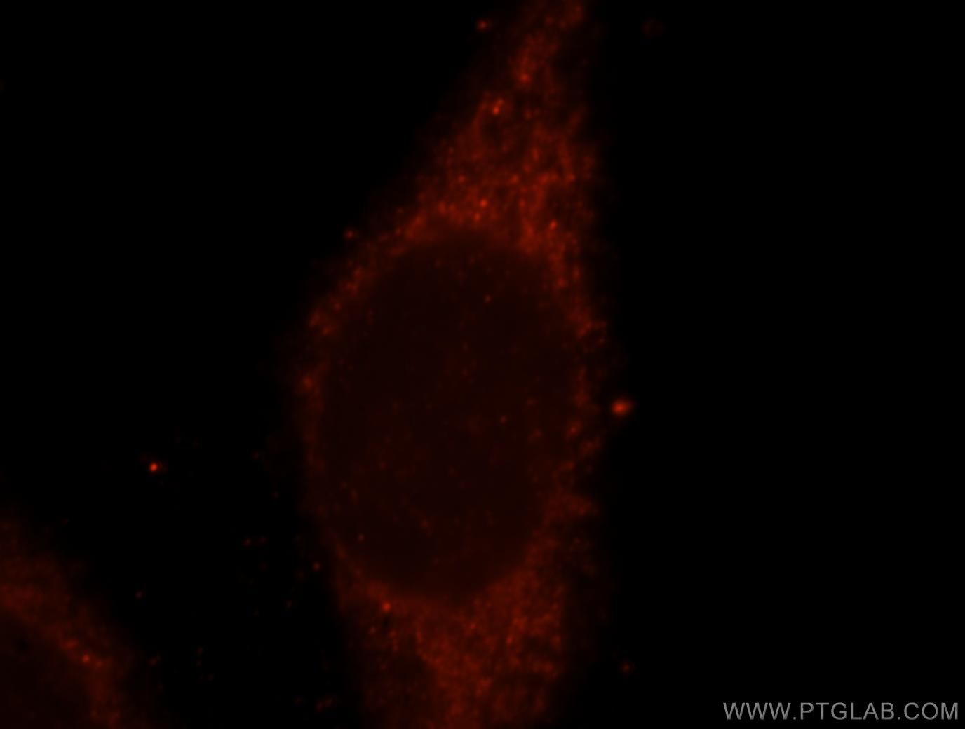 Immunofluorescence (IF) / fluorescent staining of HeLa cells using SUOX Polyclonal antibody (15075-1-AP)