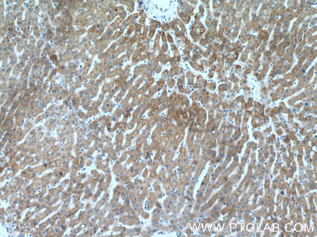 Immunohistochemistry (IHC) staining of human liver tissue using SUOX Polyclonal antibody (15075-1-AP)