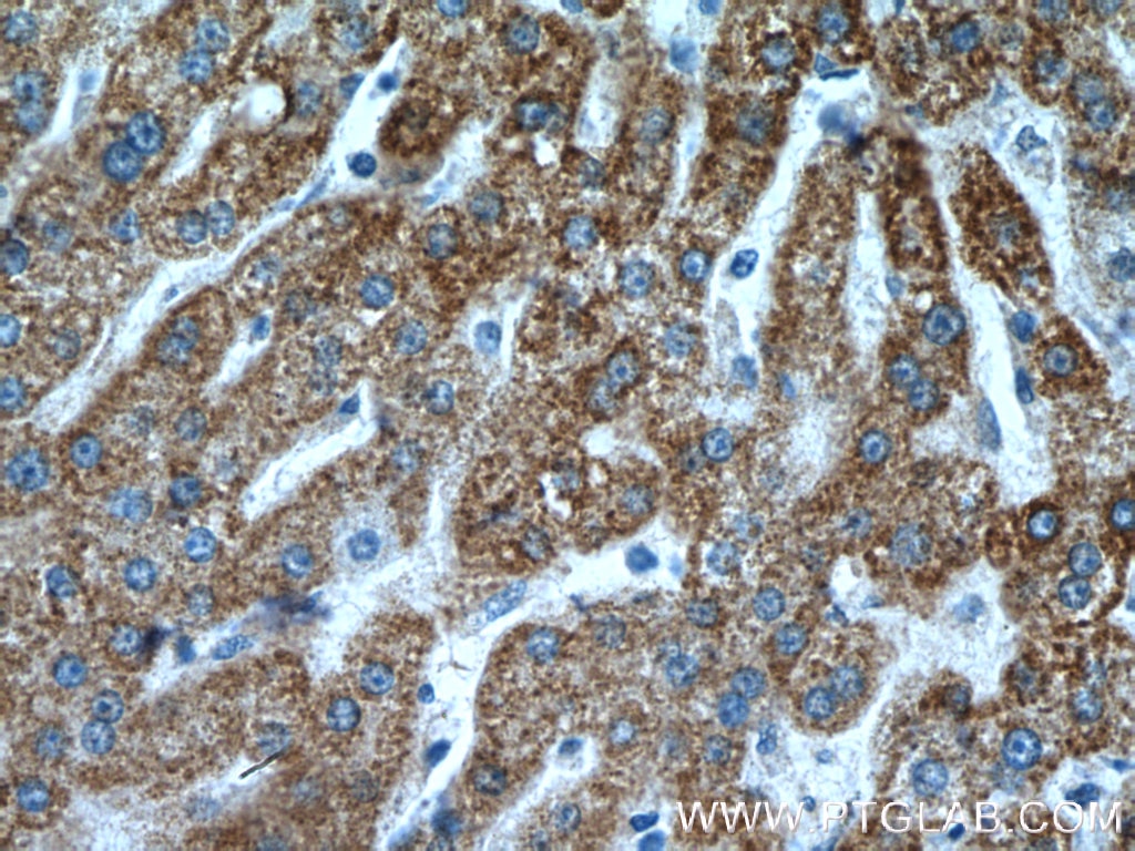 Immunohistochemistry (IHC) staining of human liver tissue using SUOX Polyclonal antibody (15075-1-AP)