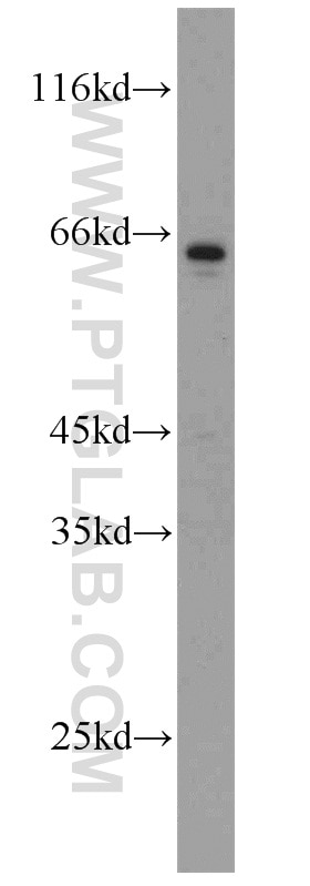 Western Blot (WB) analysis of L02 cells using SUOX Polyclonal antibody (15075-1-AP)