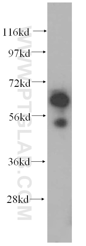 Western Blot (WB) analysis of human liver tissue using SUOX Polyclonal antibody (15075-1-AP)