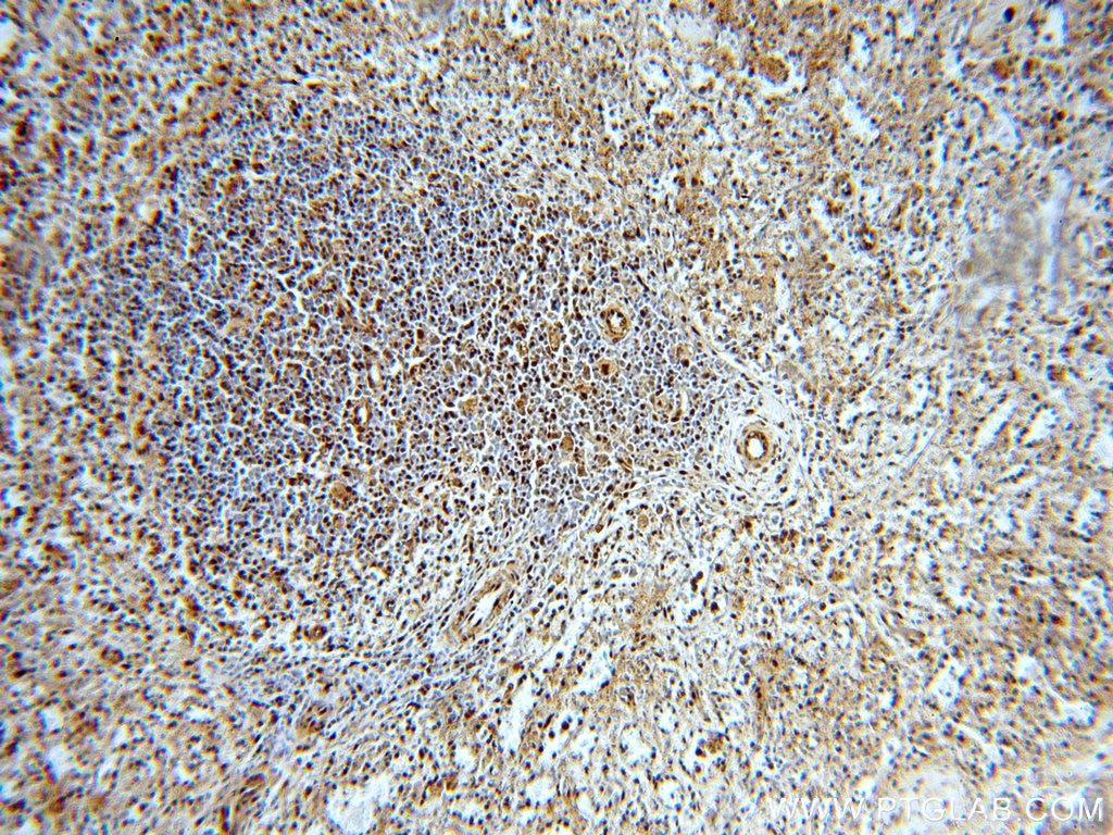 Immunohistochemistry (IHC) staining of human spleen tissue using SUPT16H Polyclonal antibody (20551-1-AP)