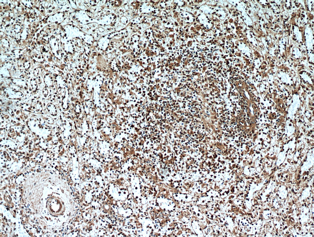 Immunohistochemistry (IHC) staining of human spleen tissue using SUPT16H Polyclonal antibody (20551-1-AP)