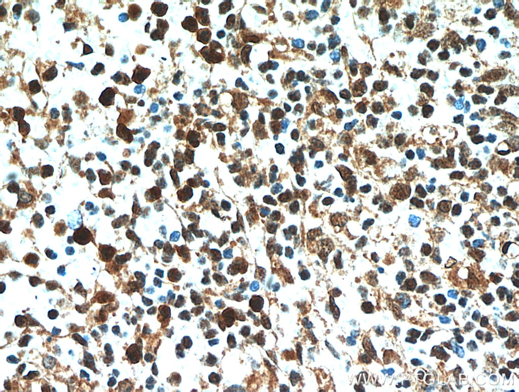 Immunohistochemistry (IHC) staining of human spleen tissue using SUPT16H Polyclonal antibody (20551-1-AP)