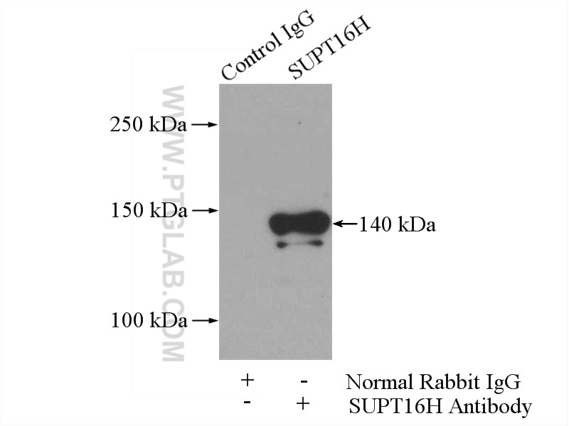 Immunoprecipitation (IP) experiment of mouse brain tissue using SUPT16H Polyclonal antibody (20551-1-AP)