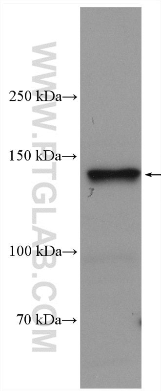 Western Blot (WB) analysis of mouse brain tissue using SUPT16H Polyclonal antibody (20551-1-AP)