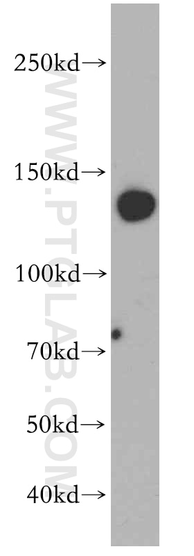 Western Blot (WB) analysis of mouse brain tissue using SUPT16H Polyclonal antibody (20551-1-AP)
