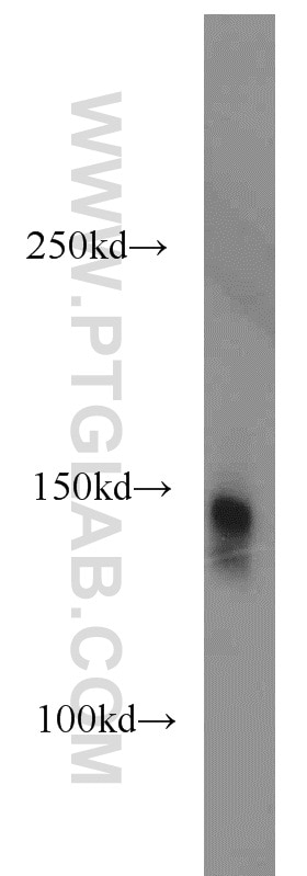 Western Blot (WB) analysis of mouse brain tissue using SUPT16H Polyclonal antibody (20551-1-AP)