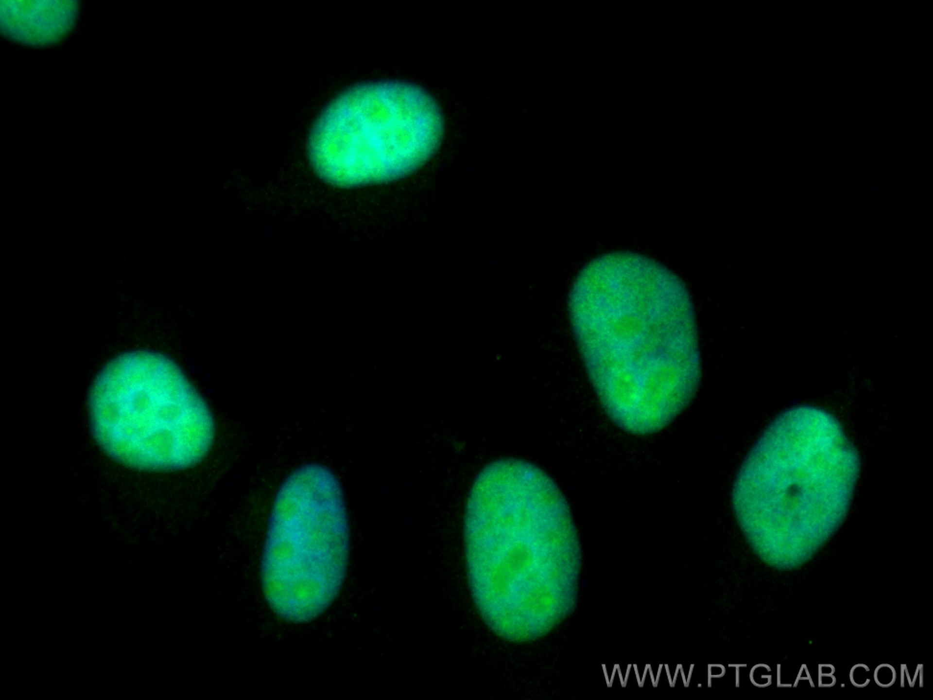 Immunofluorescence (IF) / fluorescent staining of HeLa cells using SUPT16H Polyclonal antibody (28598-1-AP)