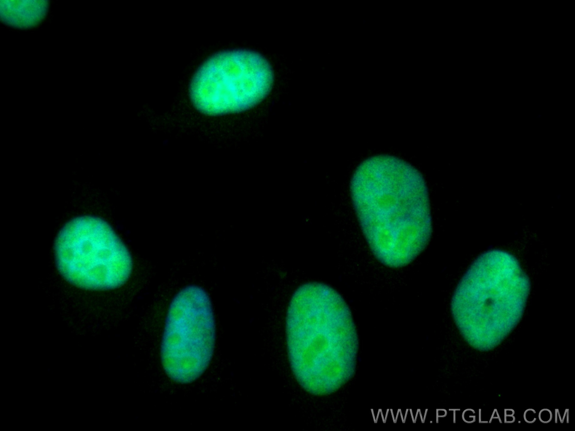 IF Staining of HeLa using 28598-1-AP