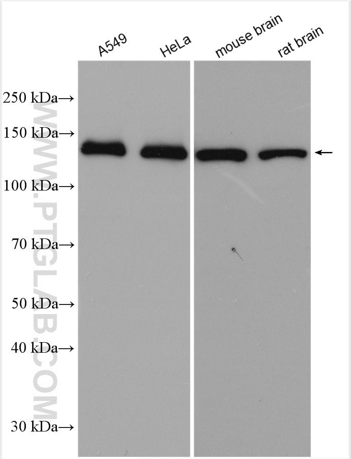 Western Blot (WB) analysis of various lysates using SUPT16H Polyclonal antibody (28598-1-AP)