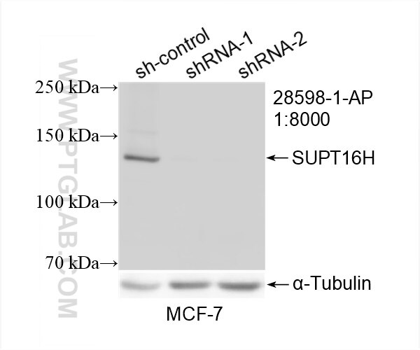 WB analysis of MCF-7 using 28598-1-AP