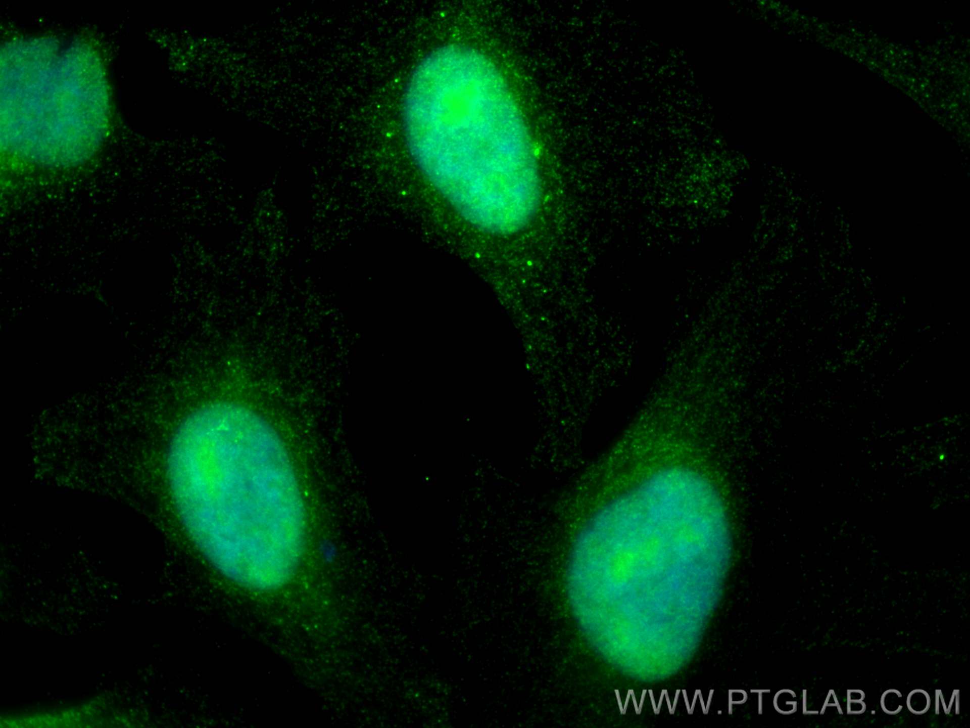 Immunofluorescence (IF) / fluorescent staining of HeLa cells using SUPT16H Monoclonal antibody (68243-1-Ig)
