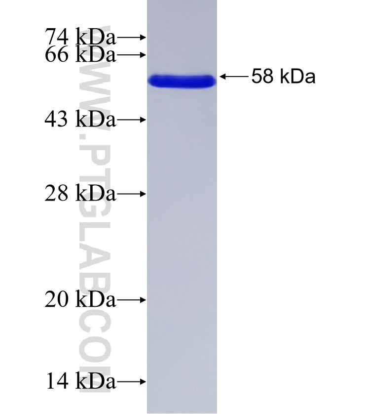 SUPT16H fusion protein Ag29459 SDS-PAGE