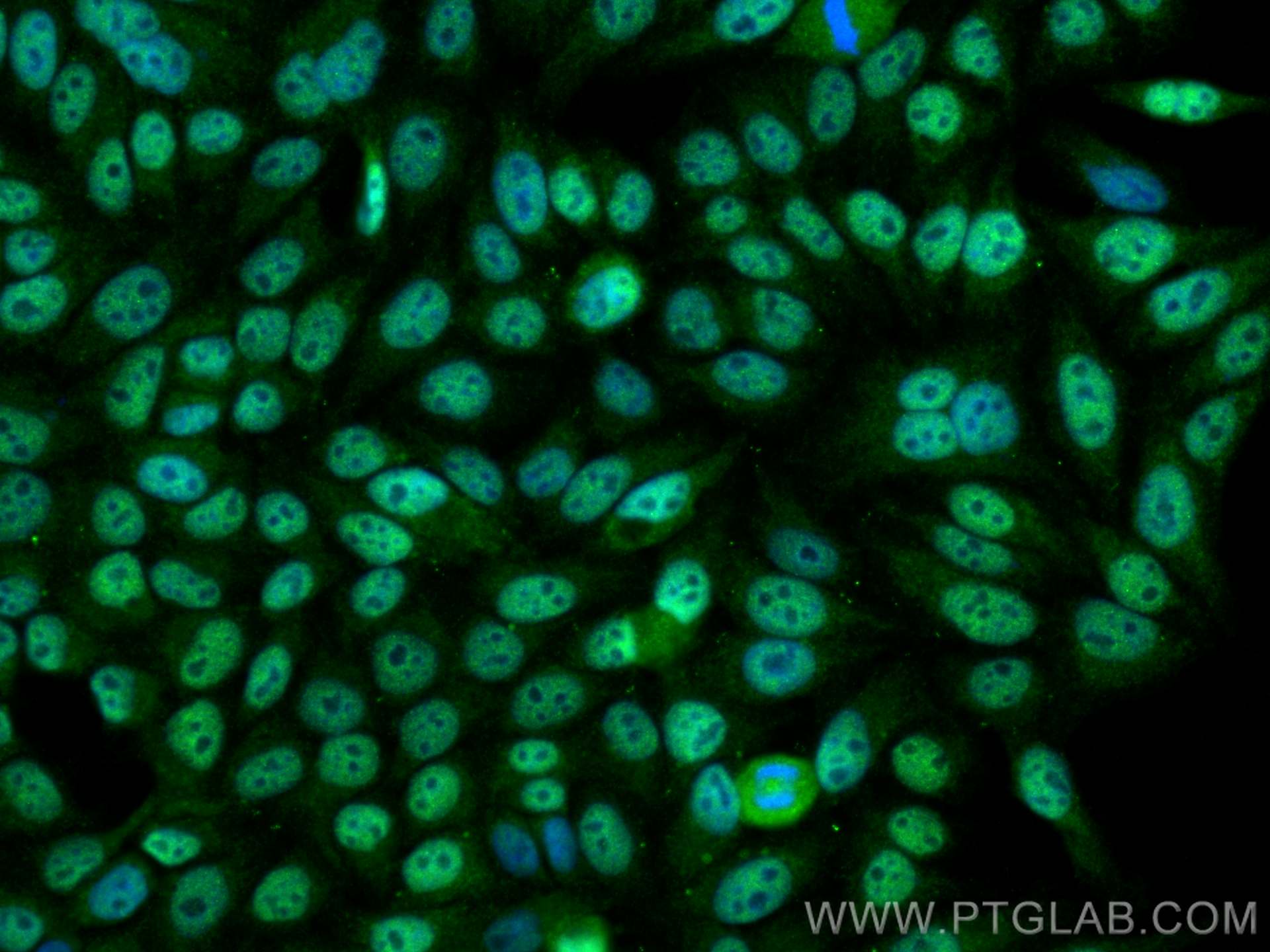 Immunofluorescence (IF) / fluorescent staining of HepG2 cells using SUPT5H Polyclonal antibody (16511-1-AP)