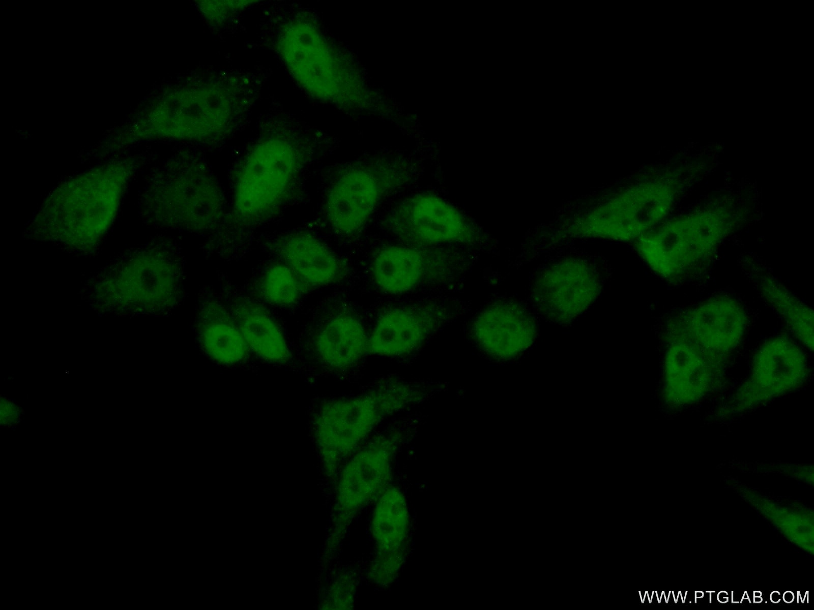 Immunofluorescence (IF) / fluorescent staining of HepG2 cells using SUPT5H Polyclonal antibody (16511-1-AP)