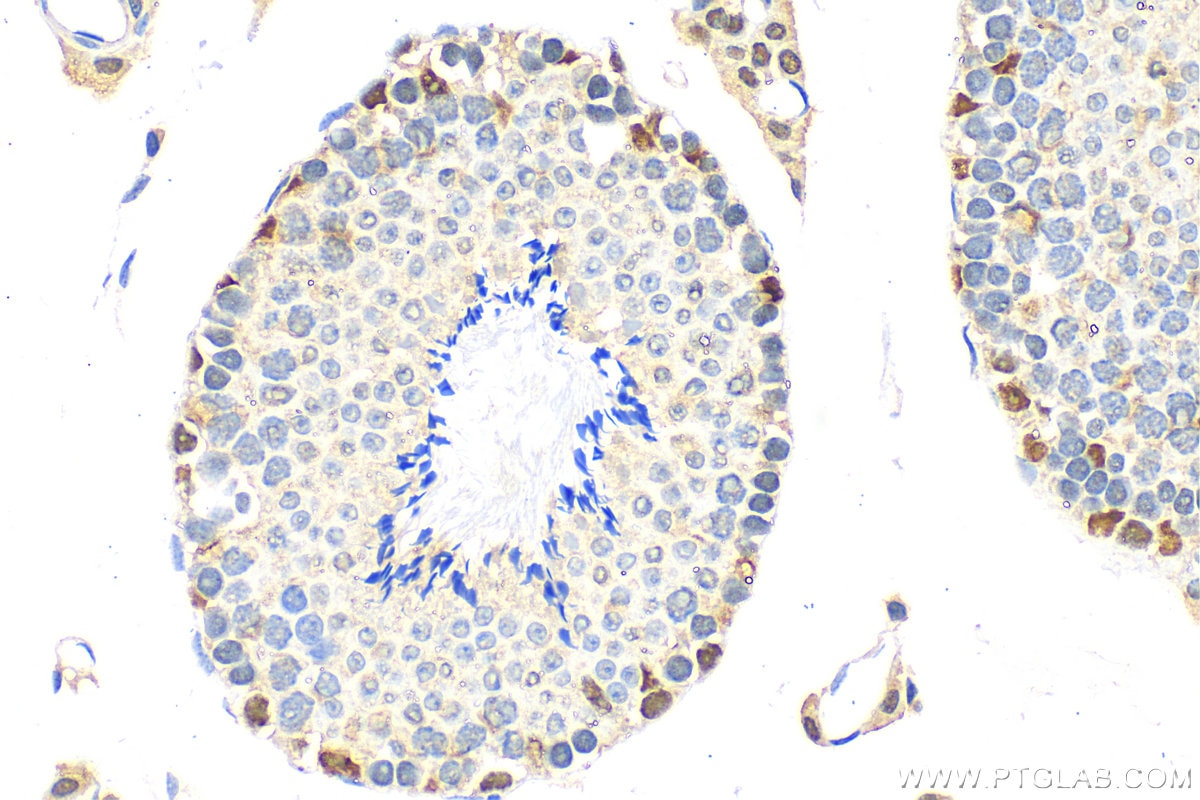Immunohistochemistry (IHC) staining of mouse testis tissue using SUPT5H Polyclonal antibody (16511-1-AP)