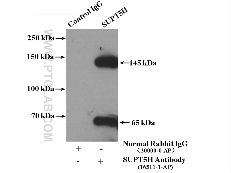 Immunoprecipitation (IP) experiment of HeLa cells using SUPT5H Polyclonal antibody (16511-1-AP)