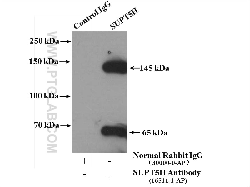 Immunoprecipitation (IP) experiment of HeLa cells using SUPT5H Polyclonal antibody (16511-1-AP)