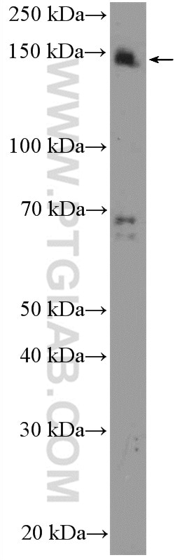 Western Blot (WB) analysis of HeLa cells using SUPT5H Polyclonal antibody (16511-1-AP)