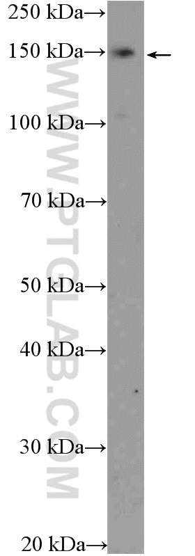 Western Blot (WB) analysis of HepG2 cells using SUPT5H Polyclonal antibody (16511-1-AP)
