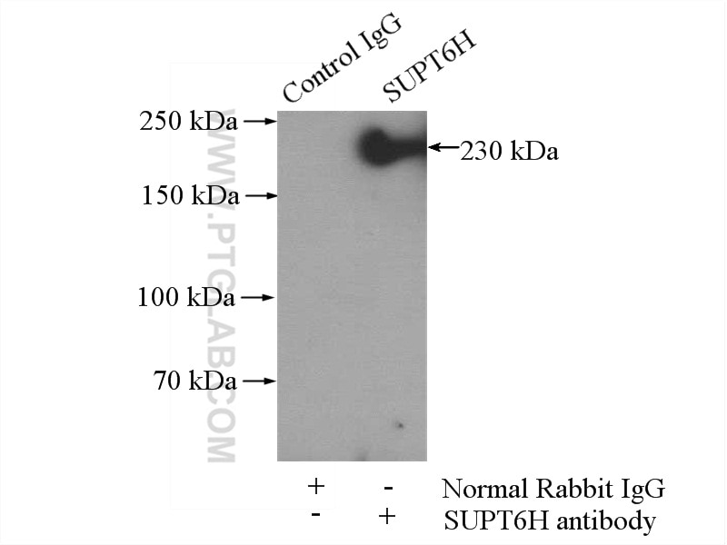 Immunoprecipitation (IP) experiment of HEK-293 cells using SUPT6H Polyclonal antibody (23073-1-AP)
