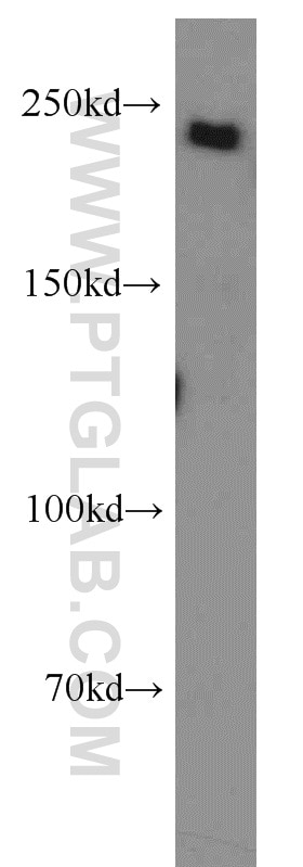 Western Blot (WB) analysis of HeLa cells using SUPT6H Polyclonal antibody (23073-1-AP)