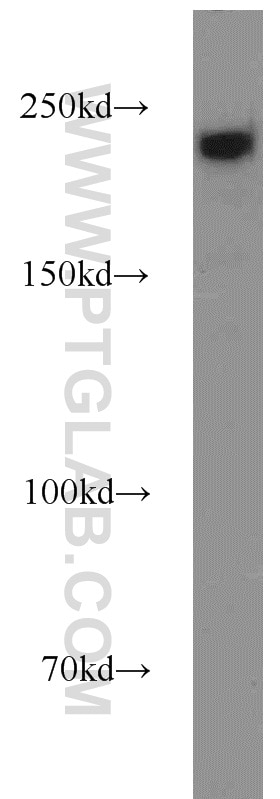 Western Blot (WB) analysis of HEK-293 cells using SUPT6H Polyclonal antibody (23073-1-AP)