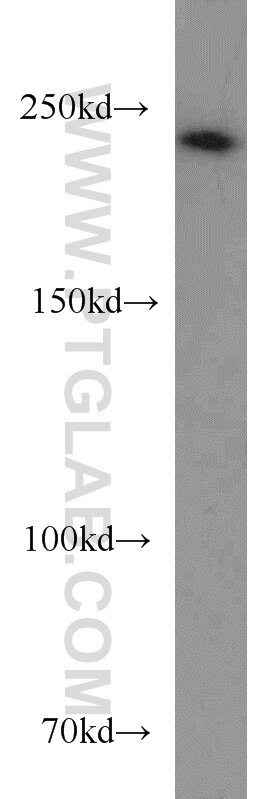 Western Blot (WB) analysis of Jurkat cells using SUPT6H Polyclonal antibody (23073-1-AP)