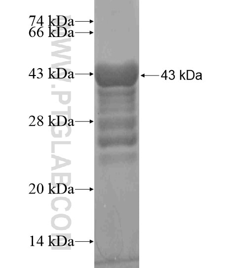 SUPT6H fusion protein Ag19426 SDS-PAGE