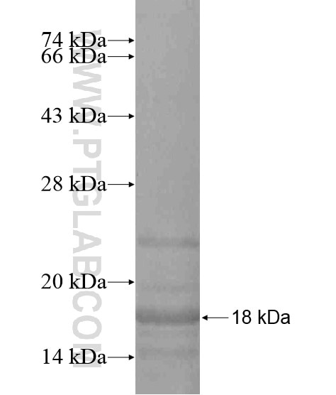 SUPT6H fusion protein Ag19492 SDS-PAGE
