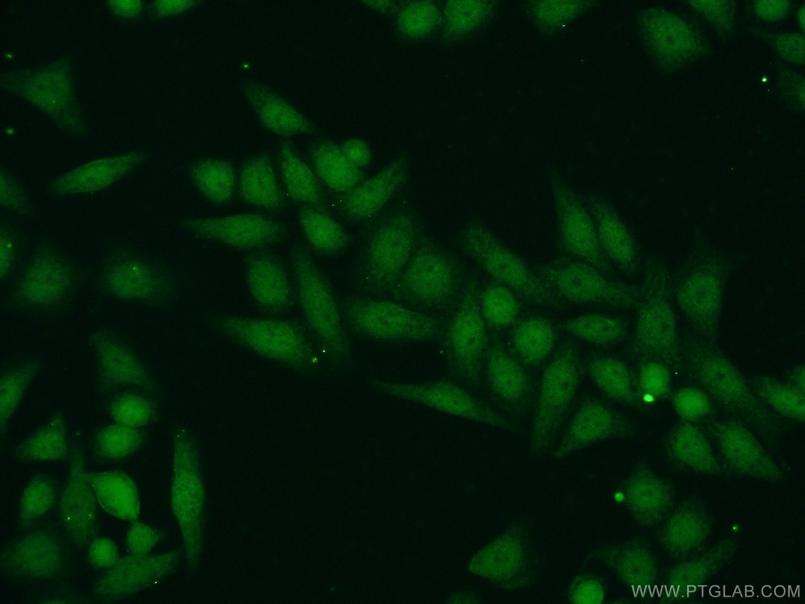Immunofluorescence (IF) / fluorescent staining of HeLa cells using SUPT7L Polyclonal antibody (25606-1-AP)