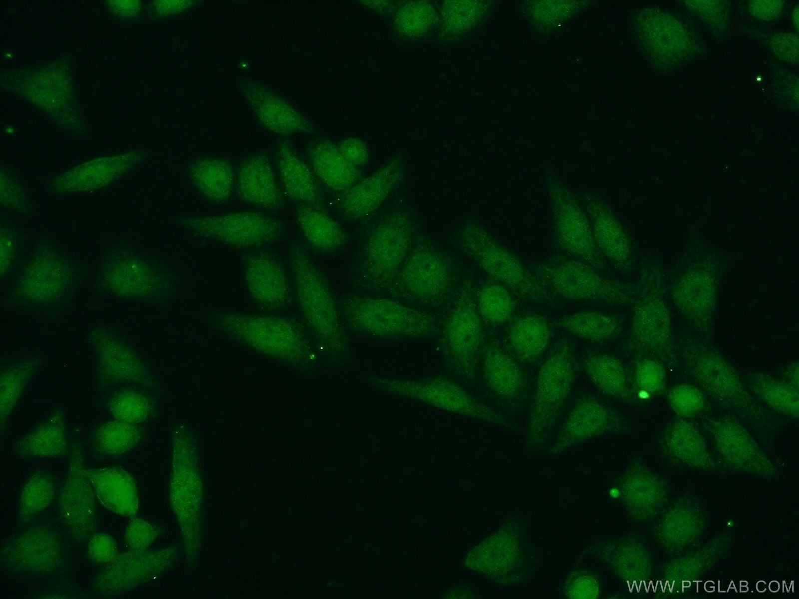 IF Staining of HeLa using 25606-1-AP