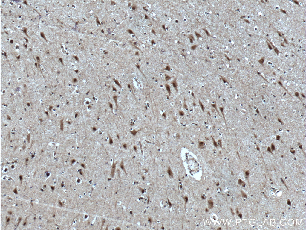 Immunohistochemistry (IHC) staining of human brain tissue using SUPT7L Polyclonal antibody (25606-1-AP)