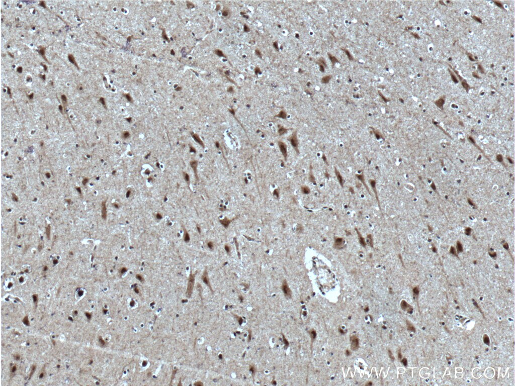 IHC staining of human brain using 25606-1-AP