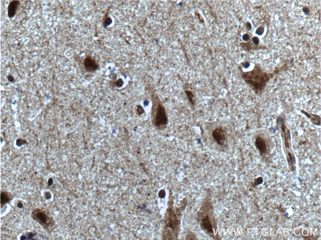 Immunohistochemistry (IHC) staining of human brain tissue using SUPT7L Polyclonal antibody (25606-1-AP)