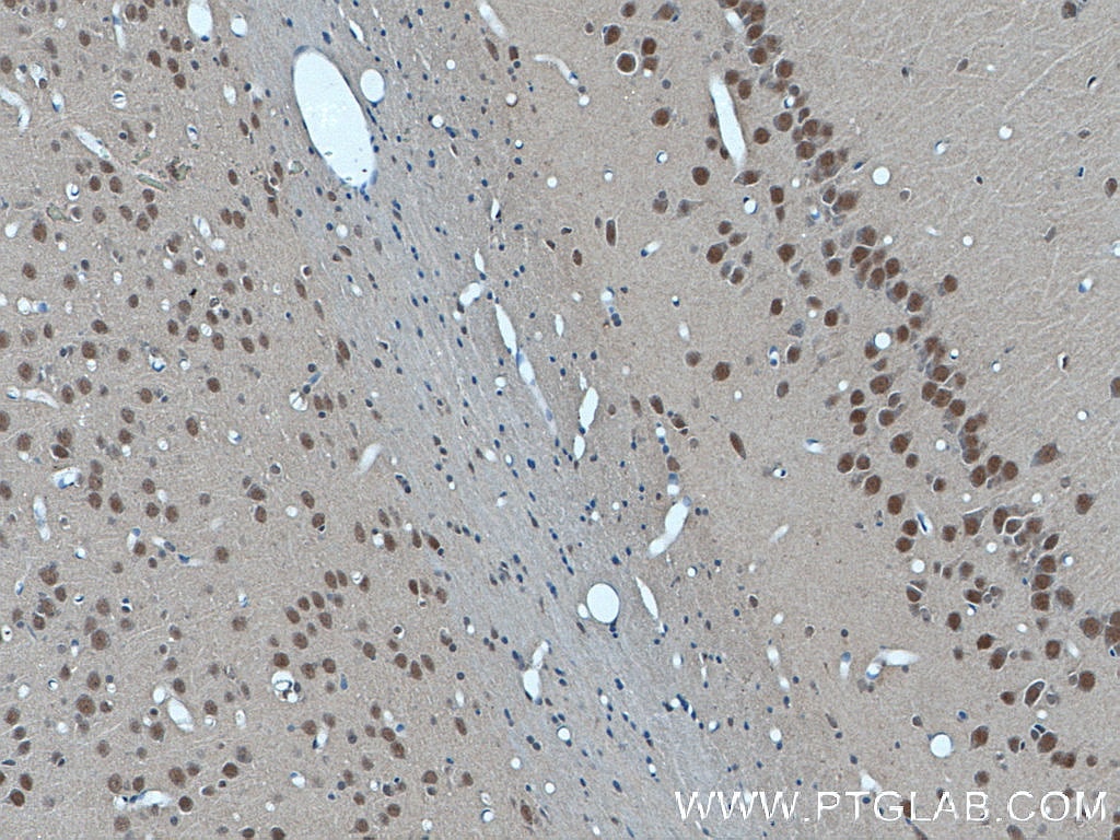 Immunohistochemistry (IHC) staining of rat brain tissue using SUPT7L Polyclonal antibody (25606-1-AP)