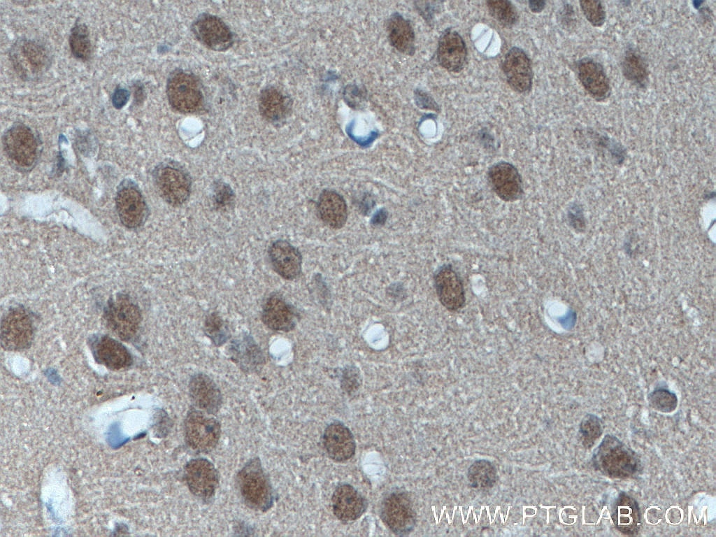 Immunohistochemistry (IHC) staining of rat brain tissue using SUPT7L Polyclonal antibody (25606-1-AP)