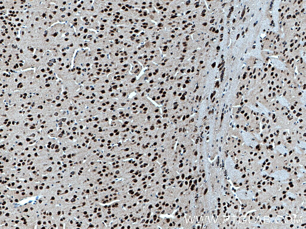 Immunohistochemistry (IHC) staining of mouse brain tissue using SUPT7L Polyclonal antibody (25606-1-AP)